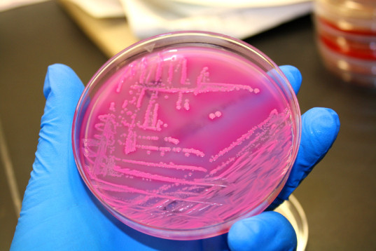 Un campione del laboratorio di ricerca