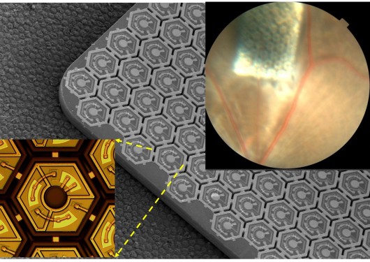 Schema di impianto delle protesi oculari fotovoltaiche